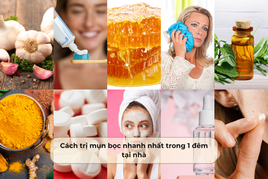 Cách trị mụn bọc nhanh nhất trong 1 đêm tại nhà