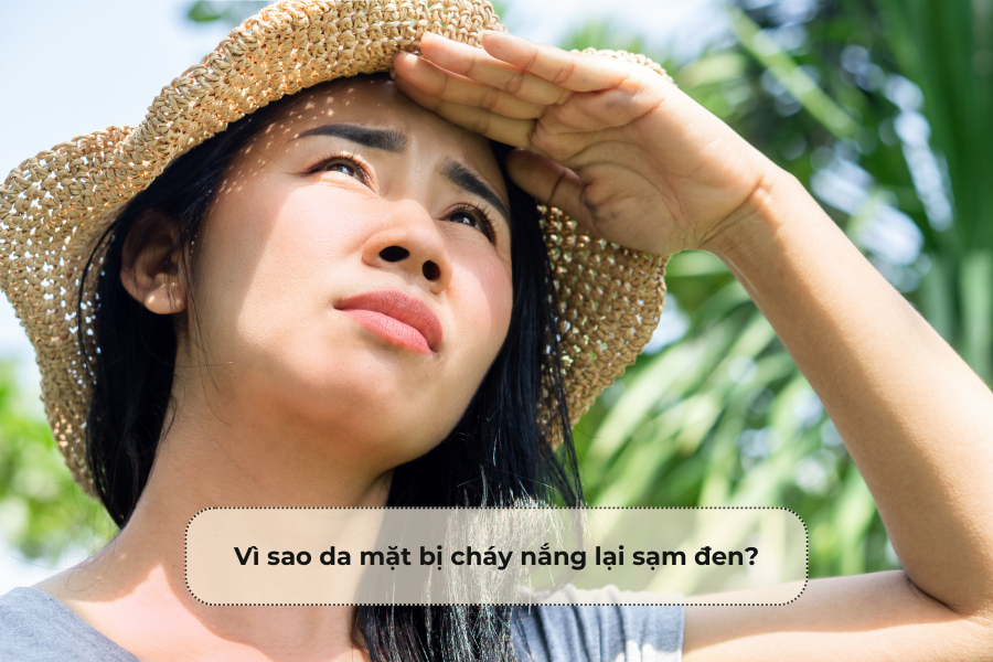 Vì sao da cháy nắng đen