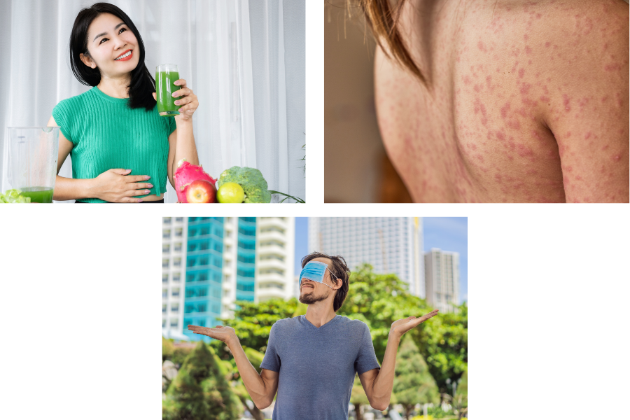Vì sao uống thuốc giải độc gan bị nổi mụn