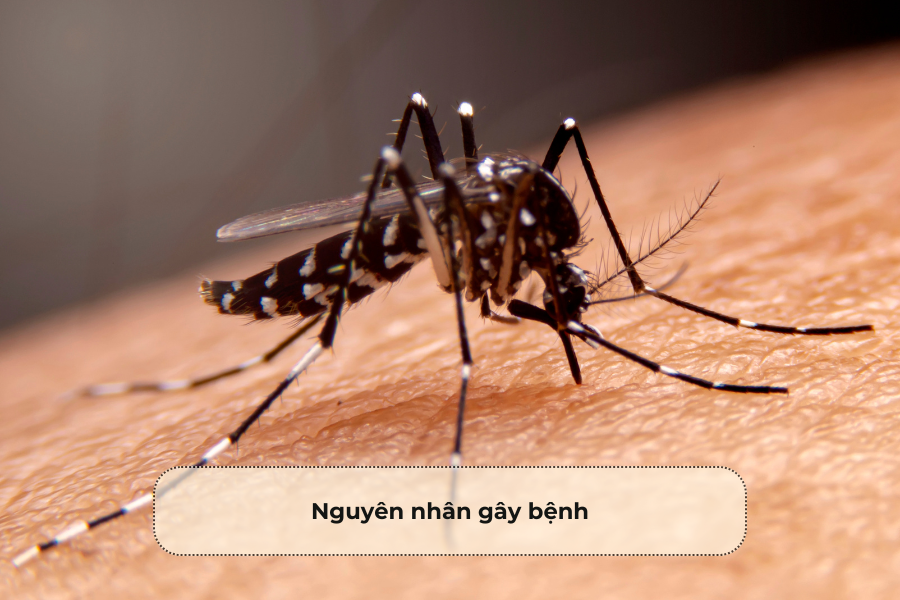 Nguyên nhân gây bệnh