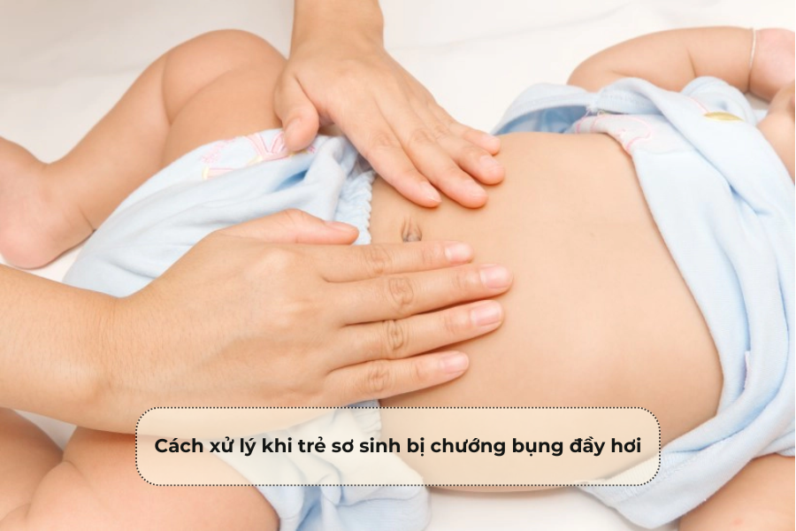 Cách xử lý khi trẻ sơ sinh bị chướng bụng đầy hơi