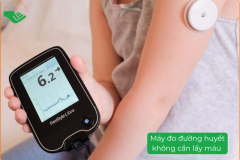 Máy Đo Đường Huyết Không Cần Lấy Máu: Góc Nhìn Trung Thực Từ Chuyên Gia Sức Khỏe