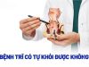 Bệnh trĩ ngoại có tự co lên không? Giải đáp từ chuyên gia